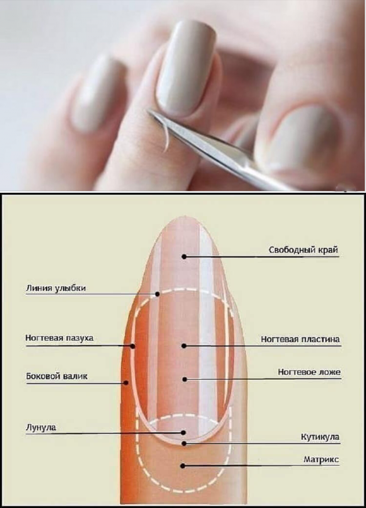 Строение ногтя птеригий. Строение ногтя схема 1. Части ногтя названия.