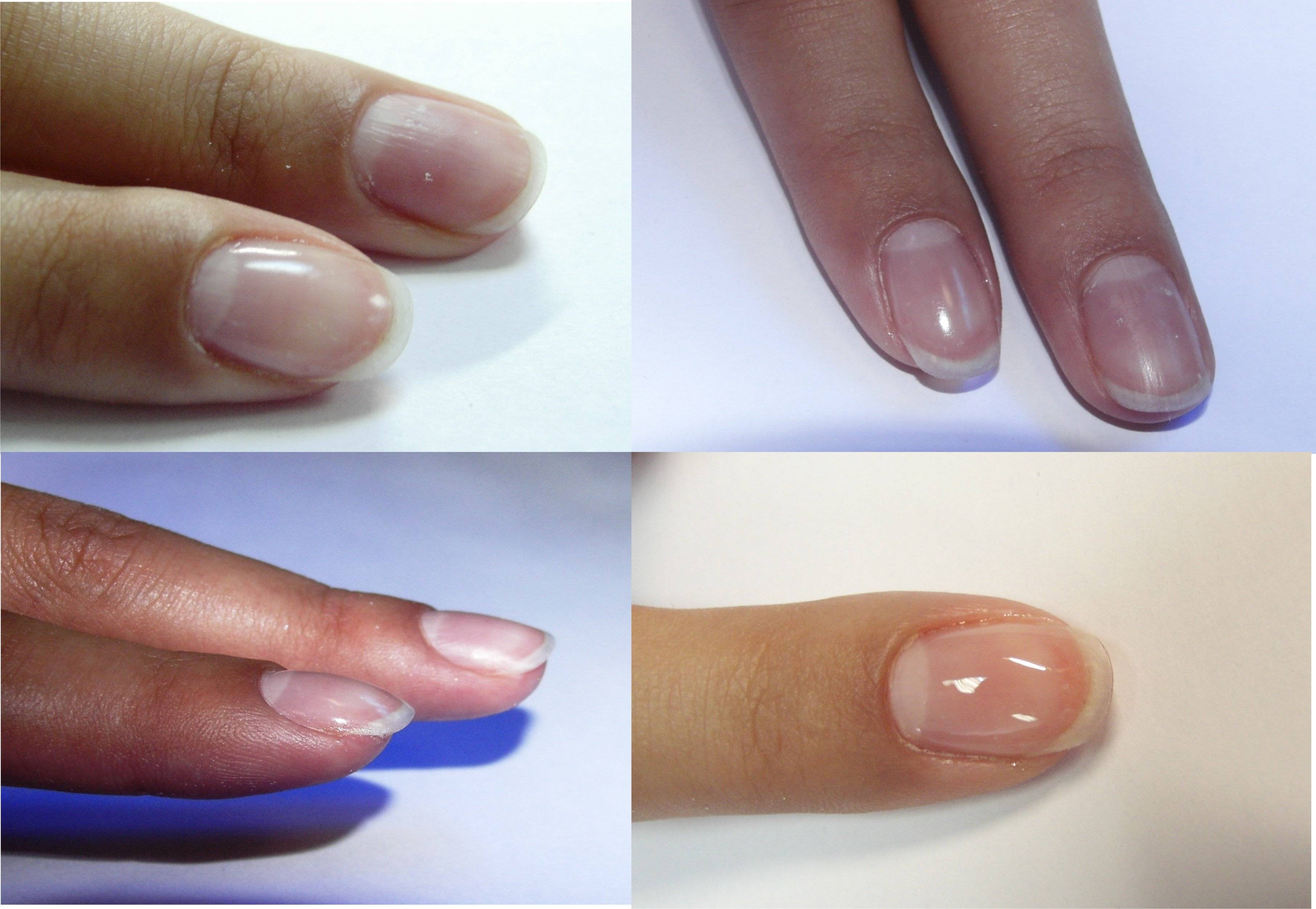 Особенности наращивания ногтей биогелем, фото. как нарастить ногти биогелем в домашних условиях пошагово