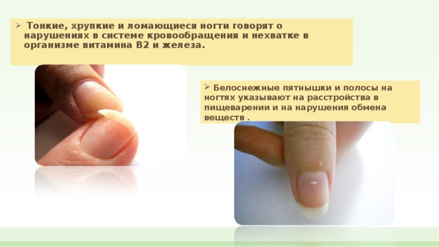 О чем говорит заболевание ногтей. Состояние здоровья по ногтям. Симптомы изменения ногтей. Изменение ногтевой пластины.