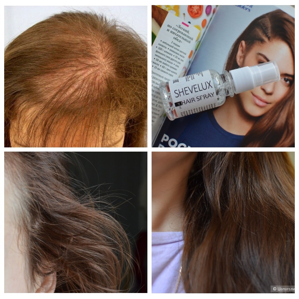 Спрей шевелюкс: 4 компонента, обеспечивающих эффективность роста волос