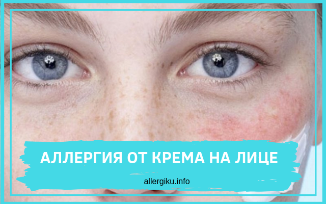 Аллергия накопительный эффект. Аллергическая реакция на крем для лица. Аллергия на лице после крема.