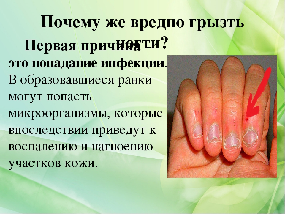 Как перестать грызть ногти - легкий способ на mymulti.ru