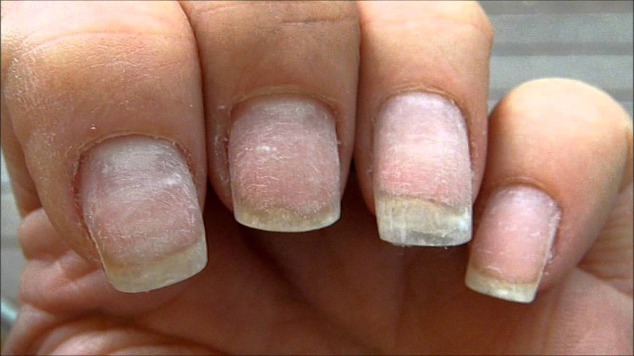 Как восстановить ногти после гель лака, быстро в домашних условиях