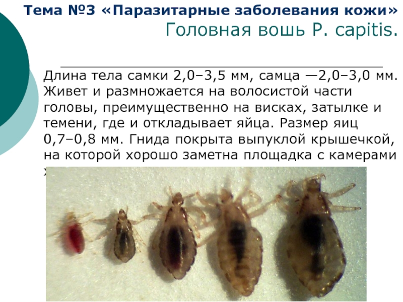 Как быстро размножаются вши: жизненный цикл