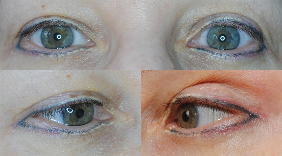 Татуаж глаз: виды перманентного татуажа век. фото до и после татуажа