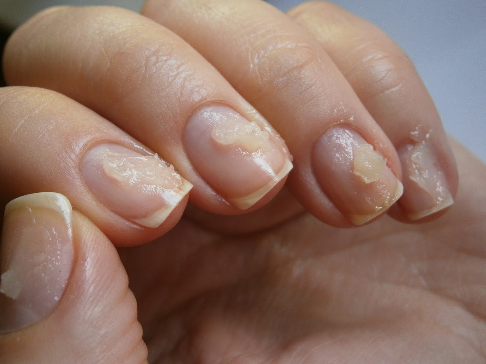 Ногти после нарощенных ногтей