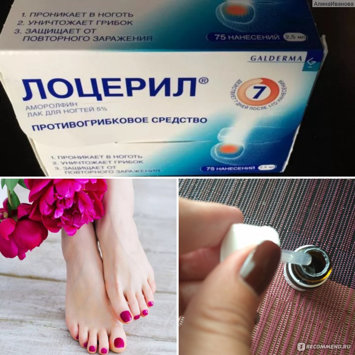 Лучшие препараты от грибка ногтей • журнал nails