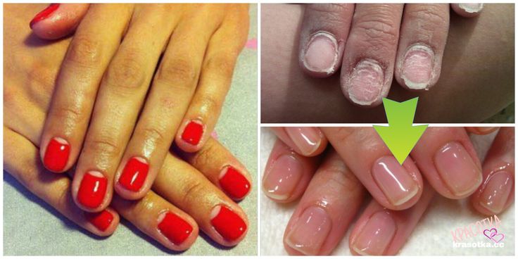 Как сделать и что такое долговременное покрытие ногтей