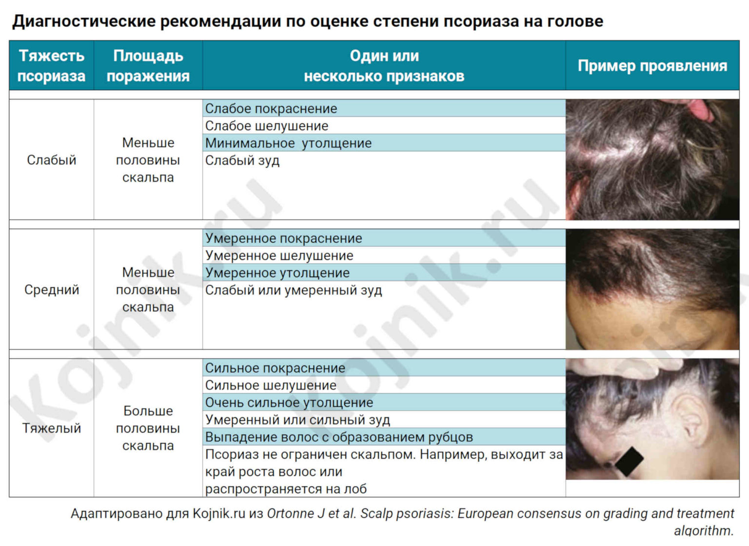 Псориаз: причины, симптомы, лечение – напоправку – напоправку