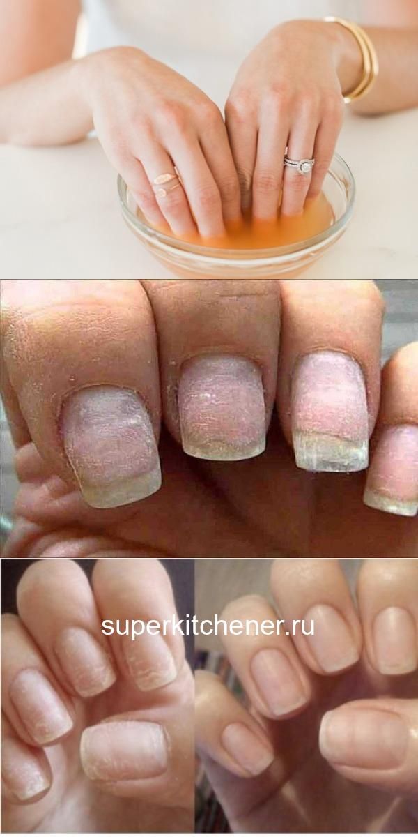 Как восстановить ногти после гель-лака: масла, кремы, процедуры с лечебным эффектом | vogue russia