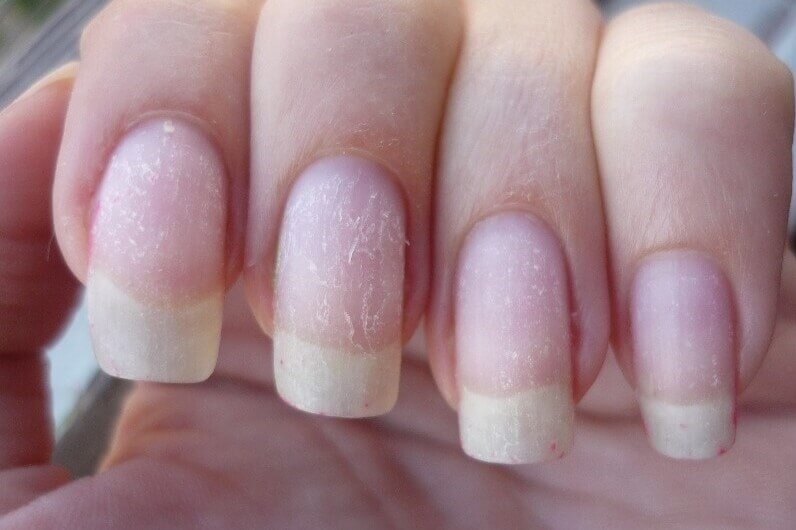 Как восстановить ногти после наращивания гелем и акрилом