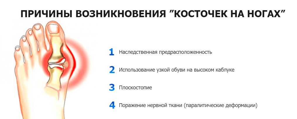 Боль в стопе [как лечить, причины и что делать когда болят ступни ног]