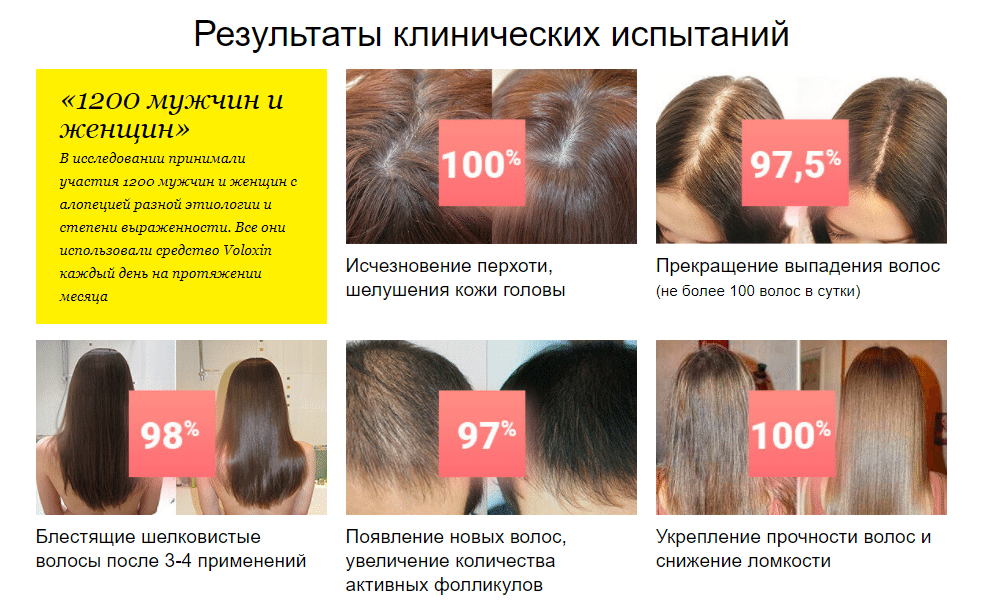 Выпадение волос у женщин: причины и лечение