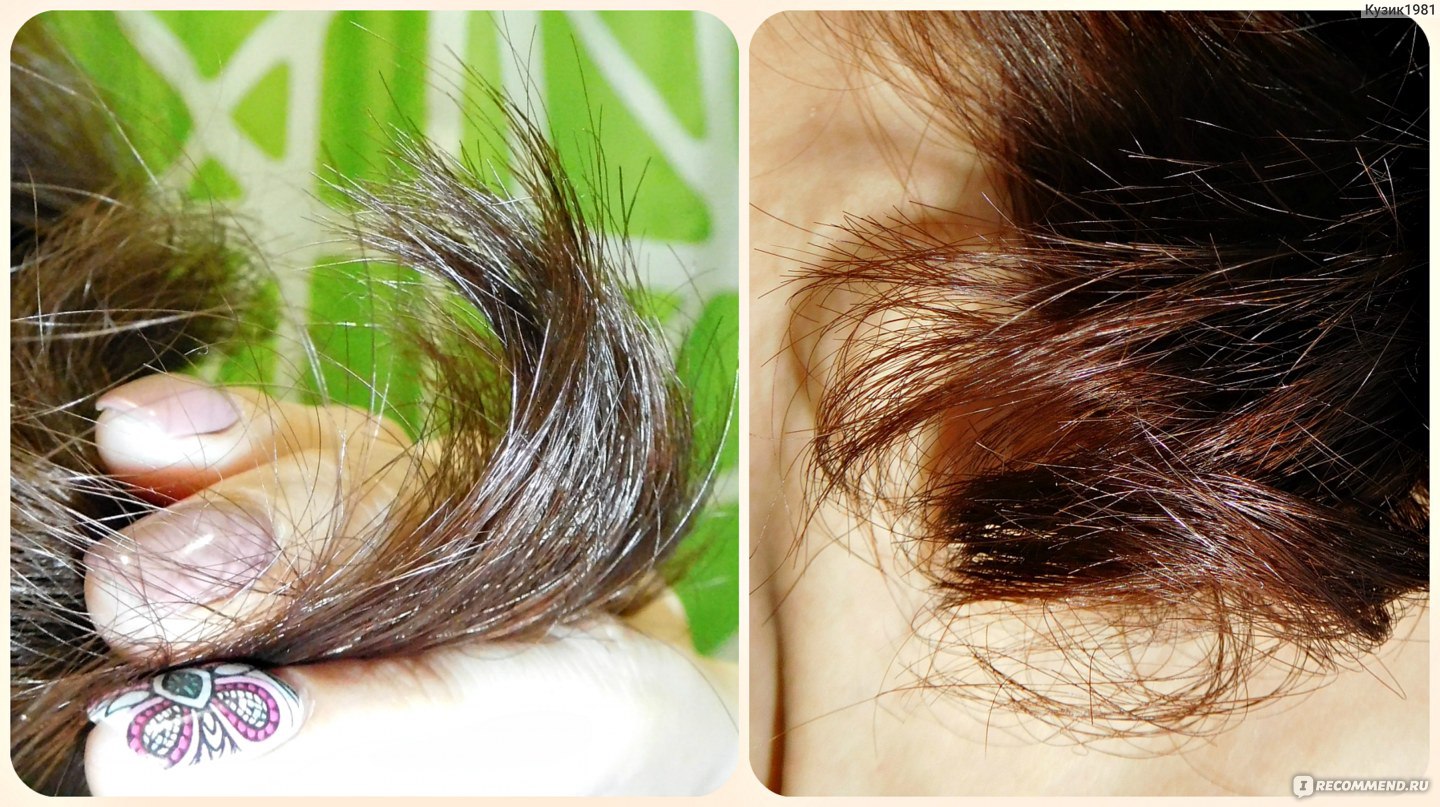 Витамин в ампулах для волос при секущихся кончиках волос