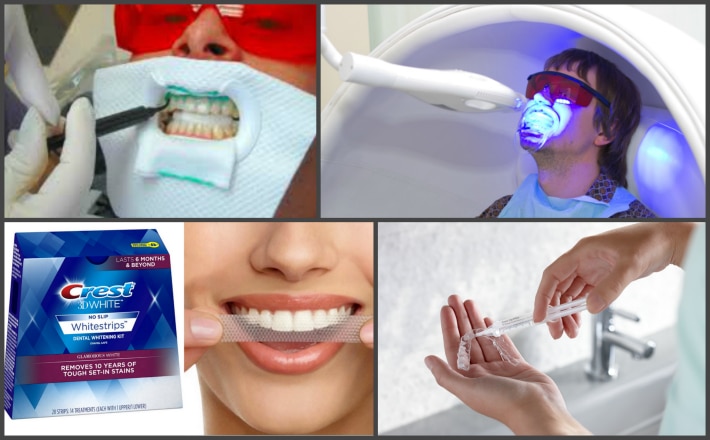 Гель для отбеливания зубов. как отбелить зубы дома? где лучше отбеливать зубы?