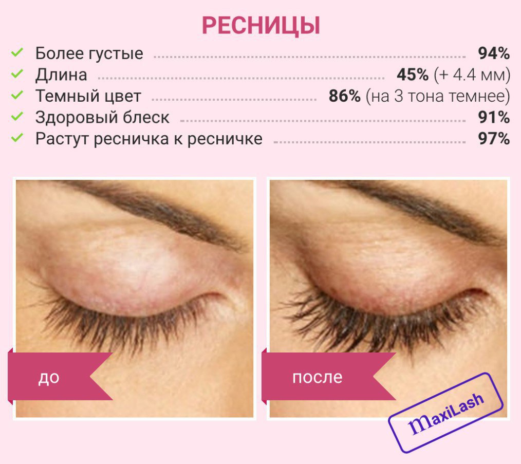 Как отрастить брови в домашних условиях?