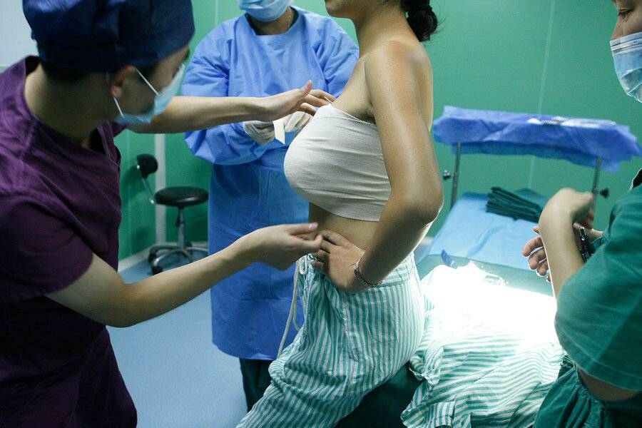 Как меняется грудь после увеличения имплантатами в течении жизни?