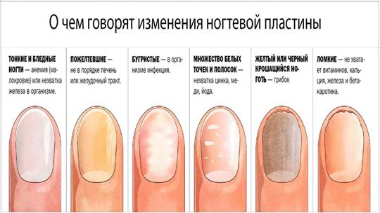 Бугристые ногти и другие типы деформации поверхности больших и остальных пальцев рук и ног у женщин и мужчин: причины, лечение, фото бугорков и иных дефектов