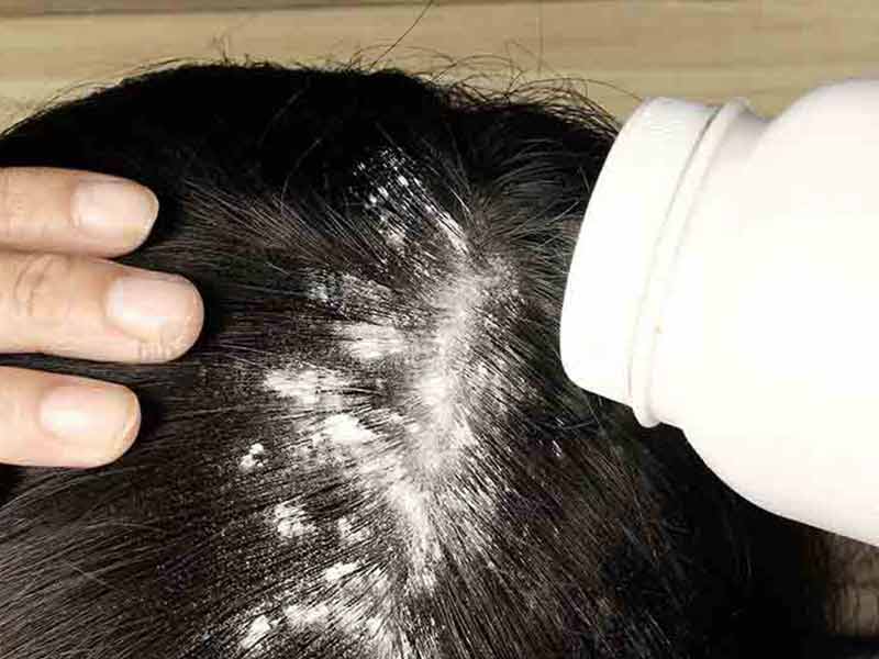 Могут ли выпадать волосы из-за шампуня от перхоти