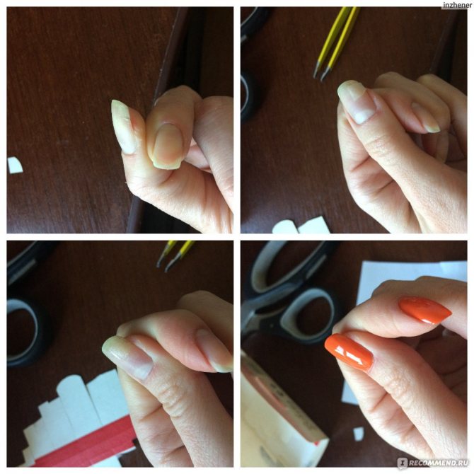 Ногти слоятся – самые простые и доступные методы борьбы