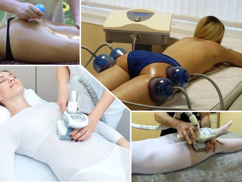 Баночный массаж от целлюлита в домашних условиях: фото, видео