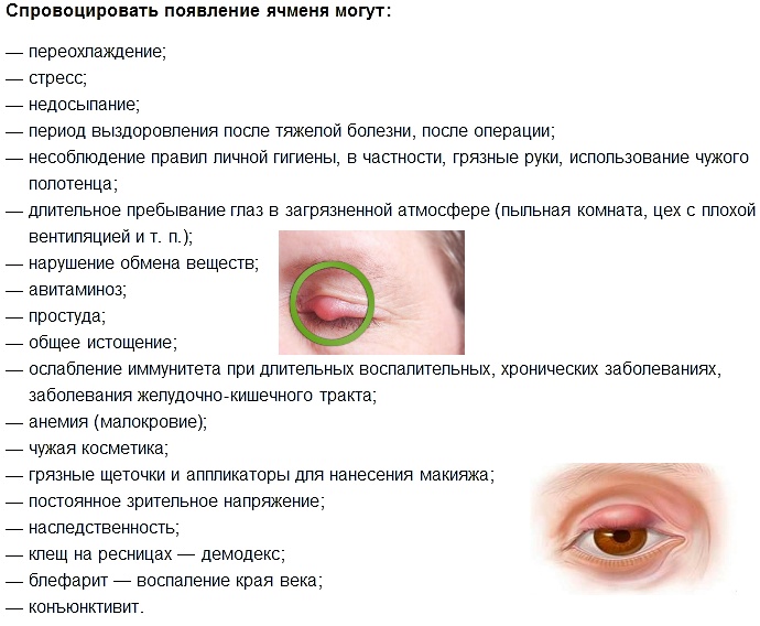 Ячмень на глазу (верхнего или нижнего века) - как лечить: можно ли греть, какие капли помогут - moscoweyes.ru - сайт офтальмологического центра "мгк-диагностик"