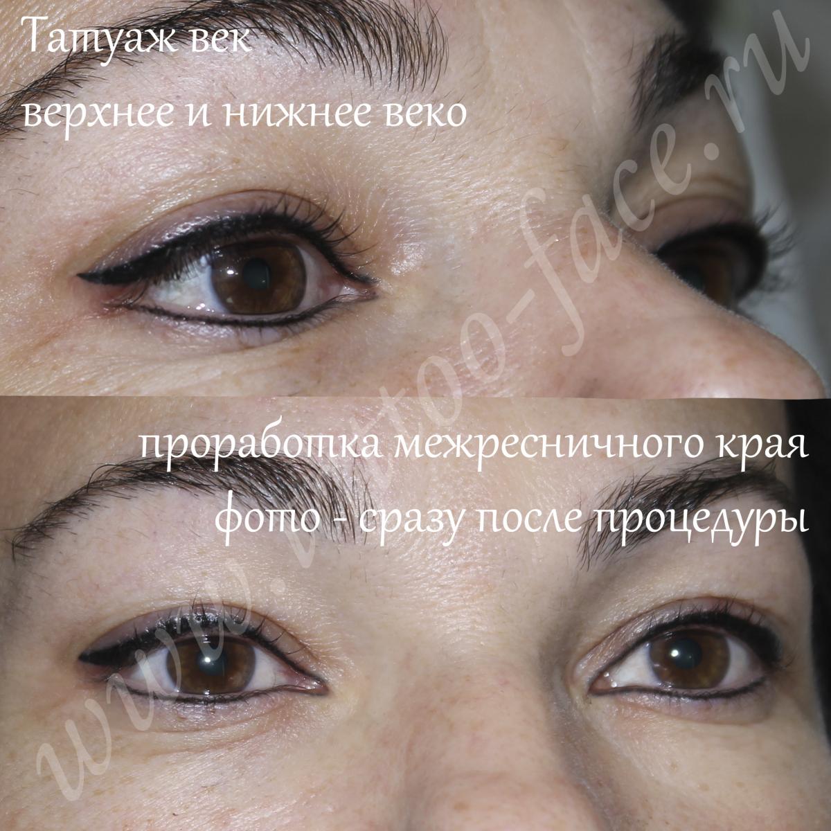 Уход после перманентного макияжа век: советы и рекомендации после татуажа глаз