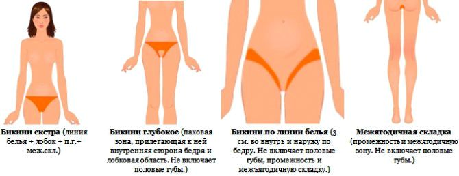 Как подготовиться к лазерной эпиляции