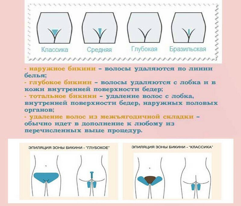 Эпиляция глубокое бикини