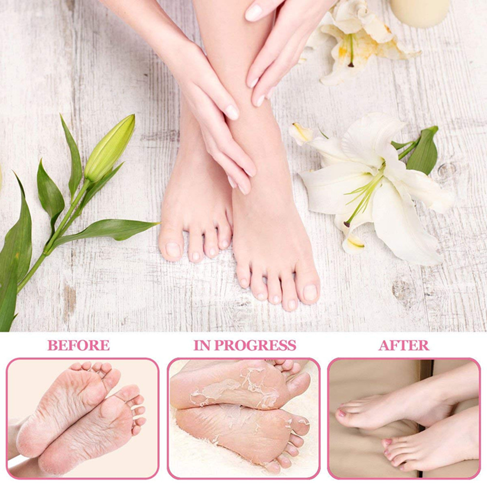 Пилинги для ног - обзор лучших • журнал nails
