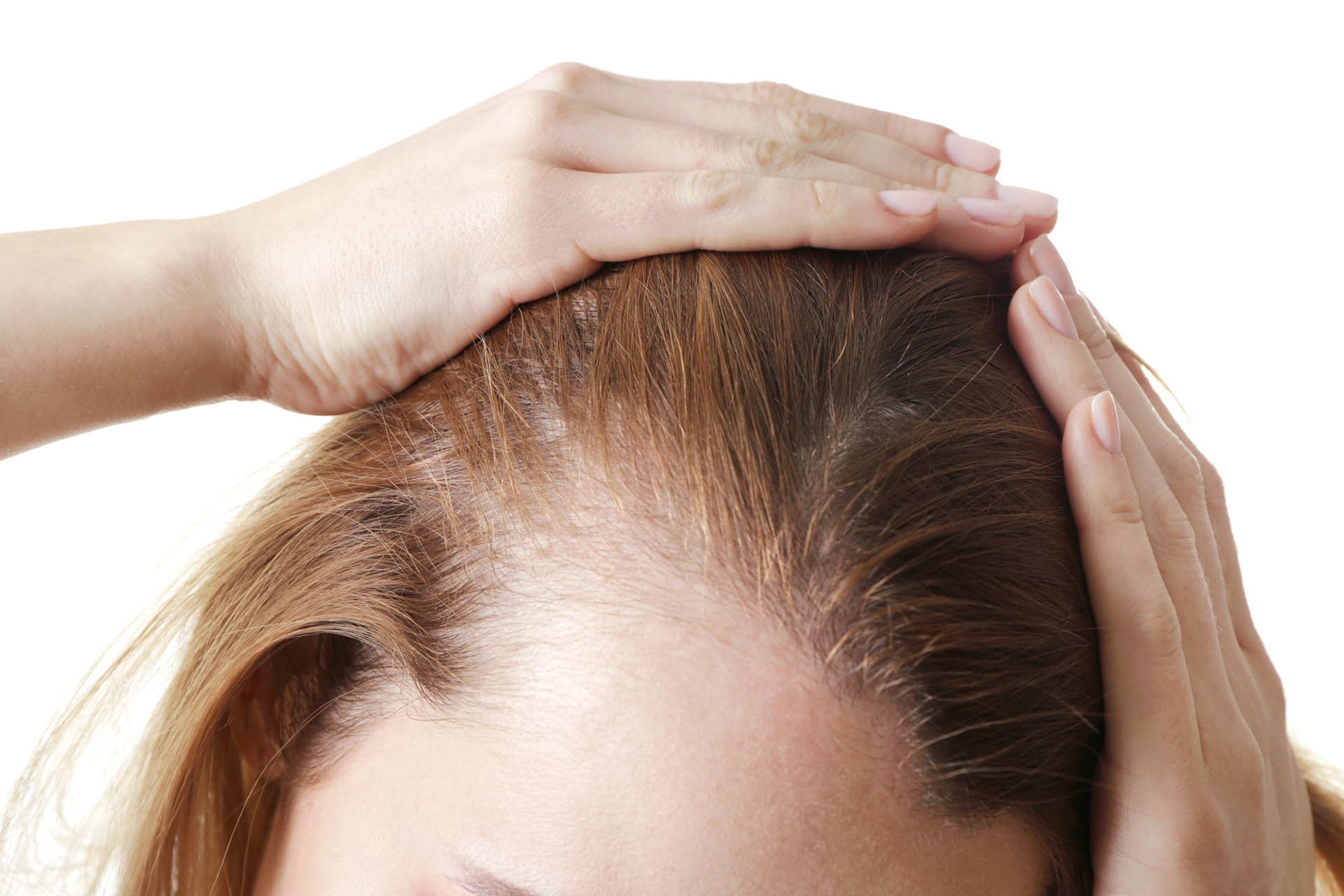 Можно ли остановить выпадение волос во время климакса