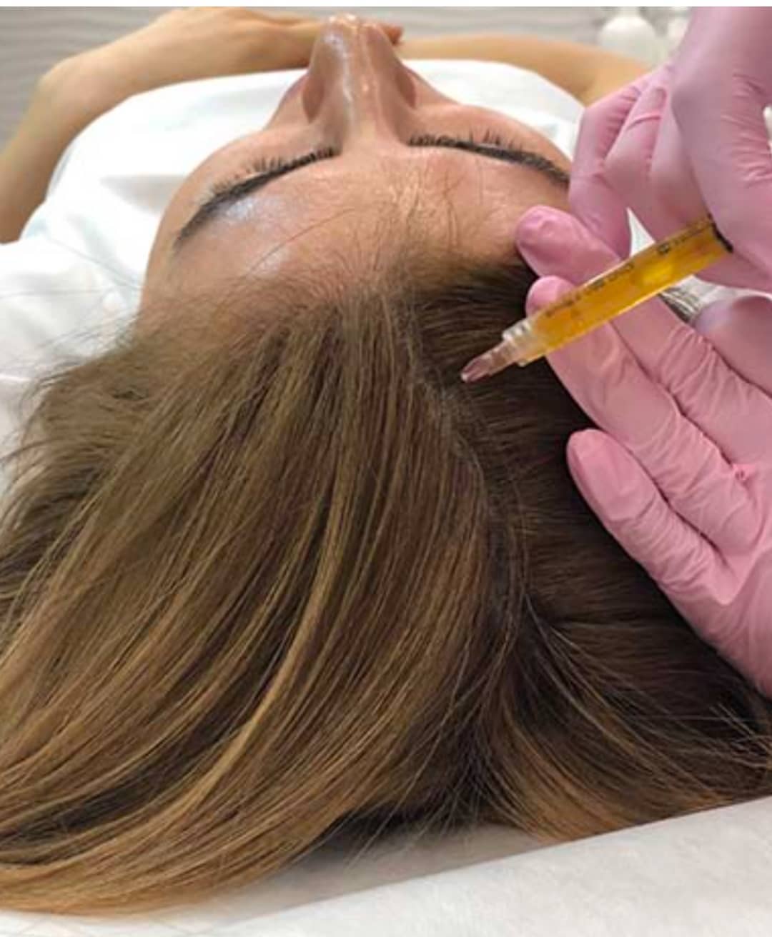 Можно ли во время мезотерапии волос красить волосы