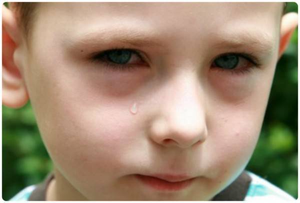 У ребенка темные круги под глазами почему