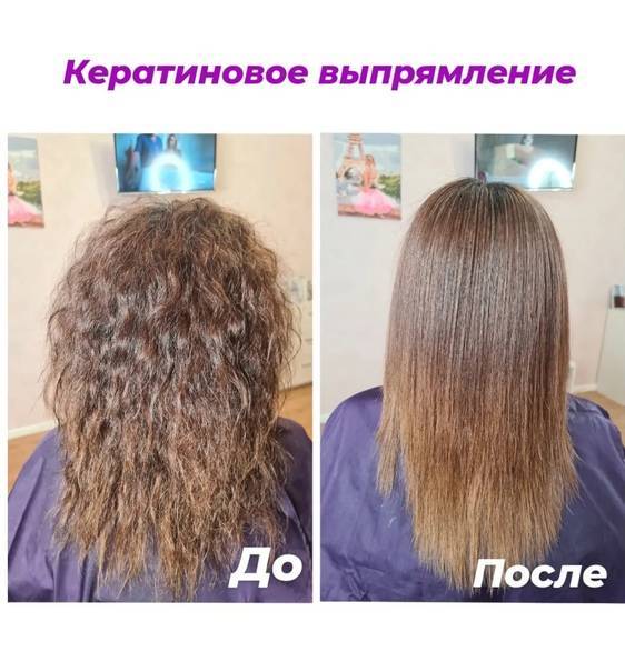 Методы и средства восстановления волос после выпадения: оценка эффективности | клиника hfe | дзен