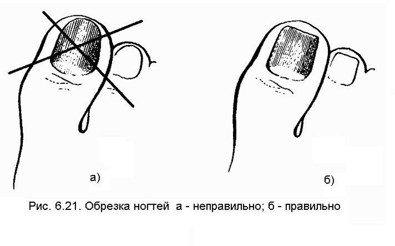 Какие бывают формы ногтей на ногах?