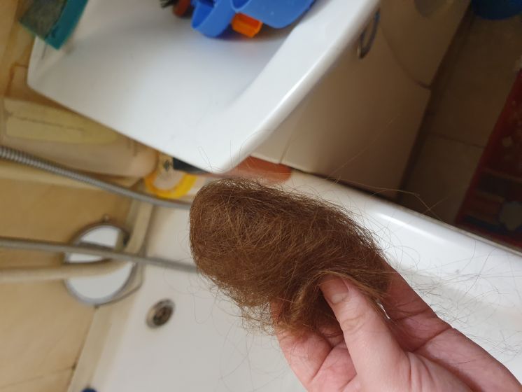 Норма выпадения волос в день: сколько вы теряете волос и каковы причины?
