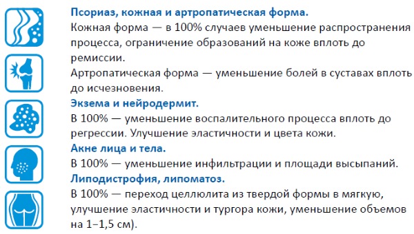 Криотерапия (криомассаж)