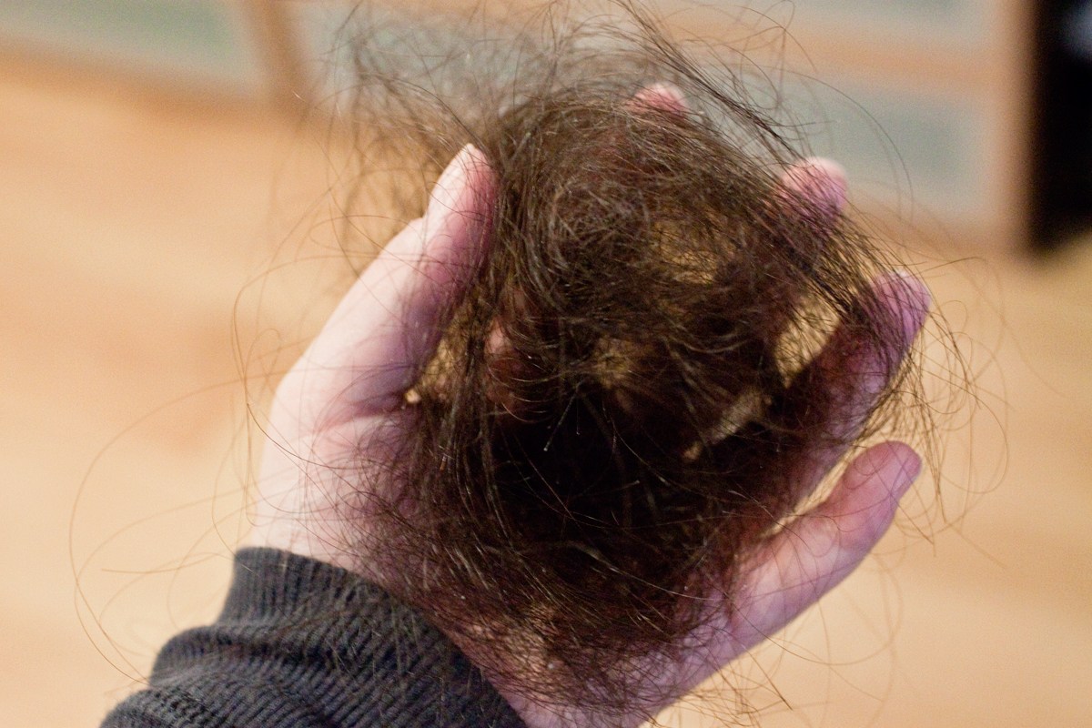 Выпадают волосы после covid-19: что делать?