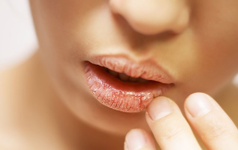 Шелушащаяся кожа на лице: от чего сильное шелушение, что делать, если она постоянно шелушится на щеках после умывания и почему, причины и лечение, как избавиться и убрать у женщин, что поможет, чем лечить