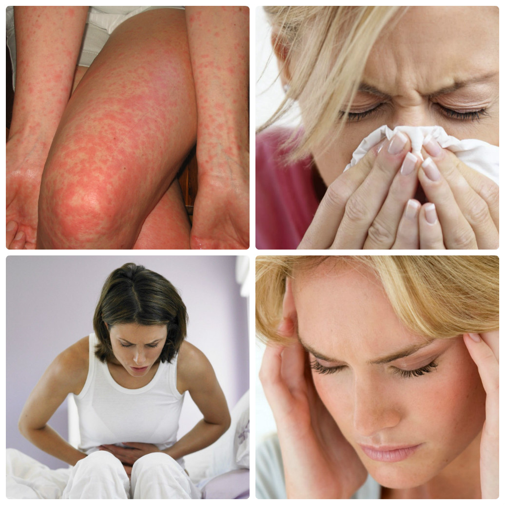 Аллергия: ликбез для аллергика. диагностика, симптомы, лечение | университетская клиника