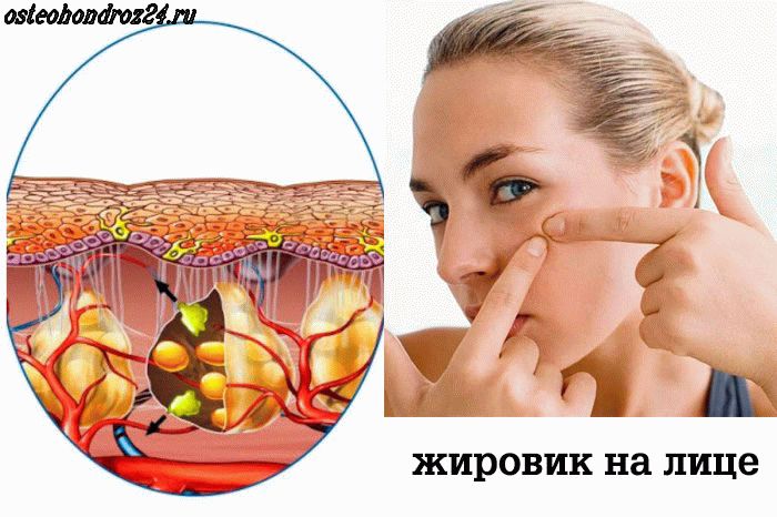 Как убрать вдовий горб с помощью одной процедуры