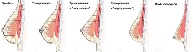 Как уменьшить грудь — самые эффективные способы - idealplastic.ru
