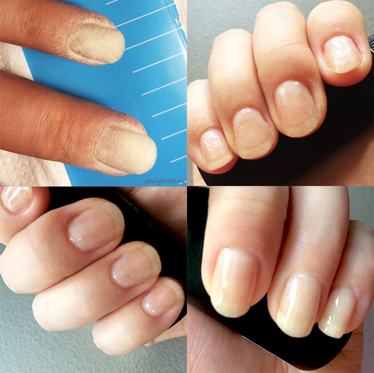 Как укрепить очень тонкие ногти гель лаком. как укрепить ногти акриловой пудрой в домашних условиях? снятие шеллака дома.