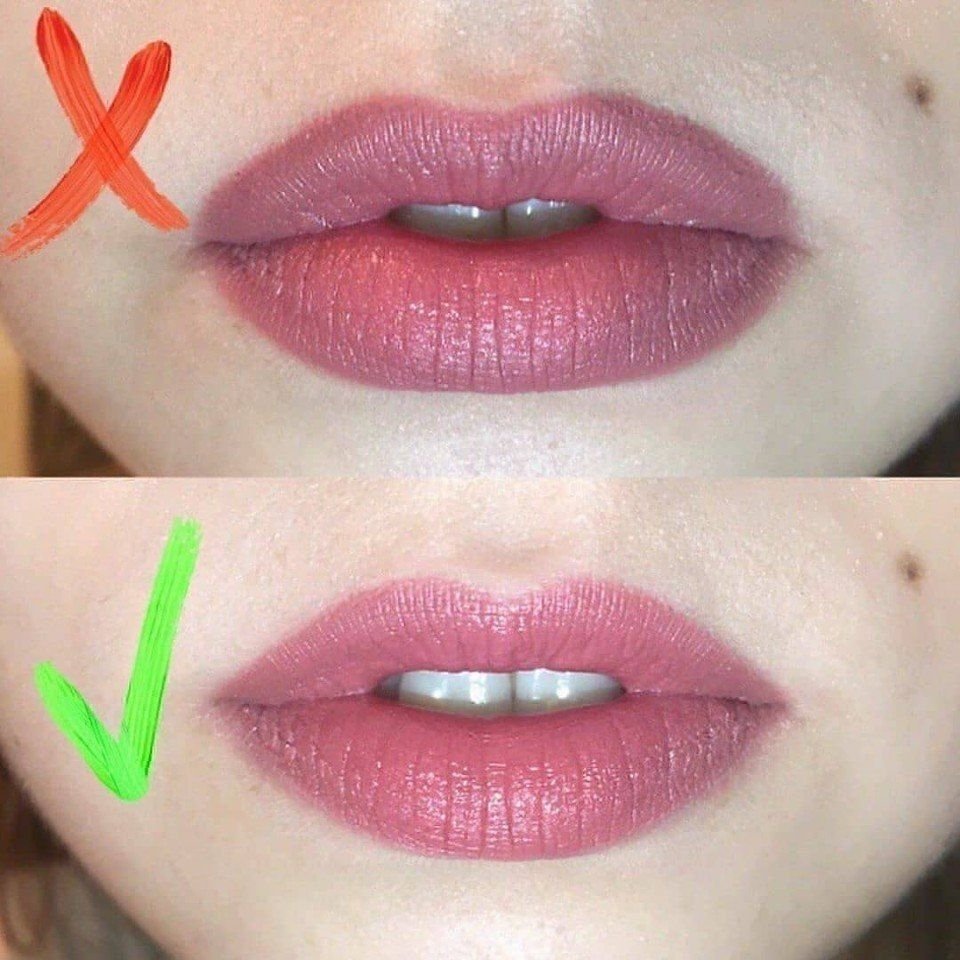 Увеличение губ: популярные техники и виды, как ухаживать за губами. противопоказания, что нельзя после процедуры, сколько держится результат