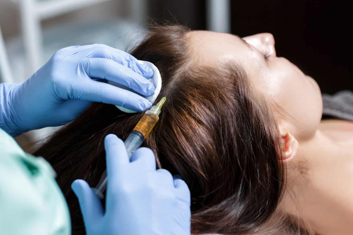 Плазмолифтинг для волос [плазмотерапия] — польза процедуры для кожи головы и волос