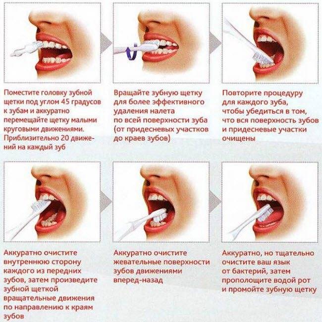 10 вопросов гигиенисту о профессиональной чистке зубов | стоматология roott | дзен