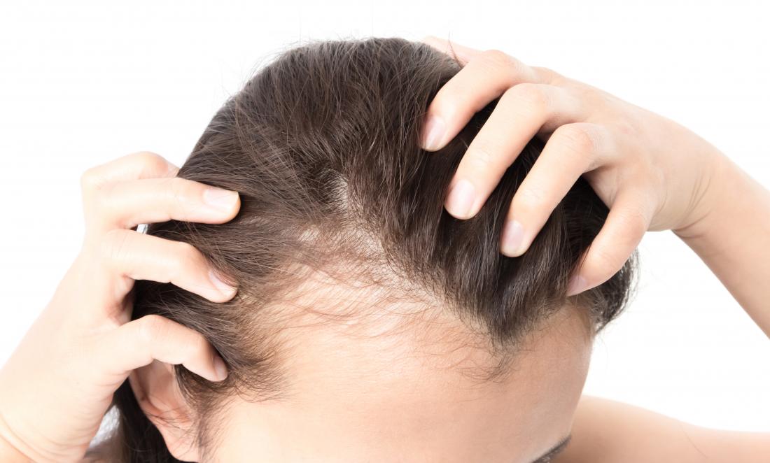 Выпадение волос у женщин [причины] — что делать если сильно выпадают волосы на голове