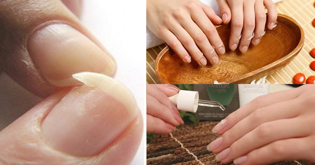 Как укрепить ногти на руках в домашних условиях