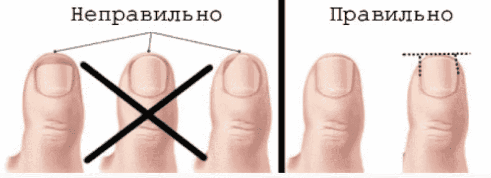 Как правильно подстригать ногти ребенку — статьи и полезные материалы от narmed.ru