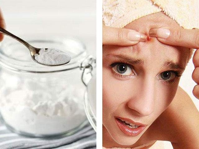 Как избавиться от постакне: убираем рубцы и красные пятна средствами или у косметолога, эффективное лечение шрамов на лице
